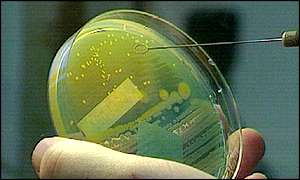 E. coli bacteria in the laboratory BBC